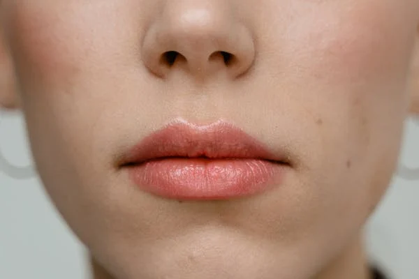 Double Chin Removal